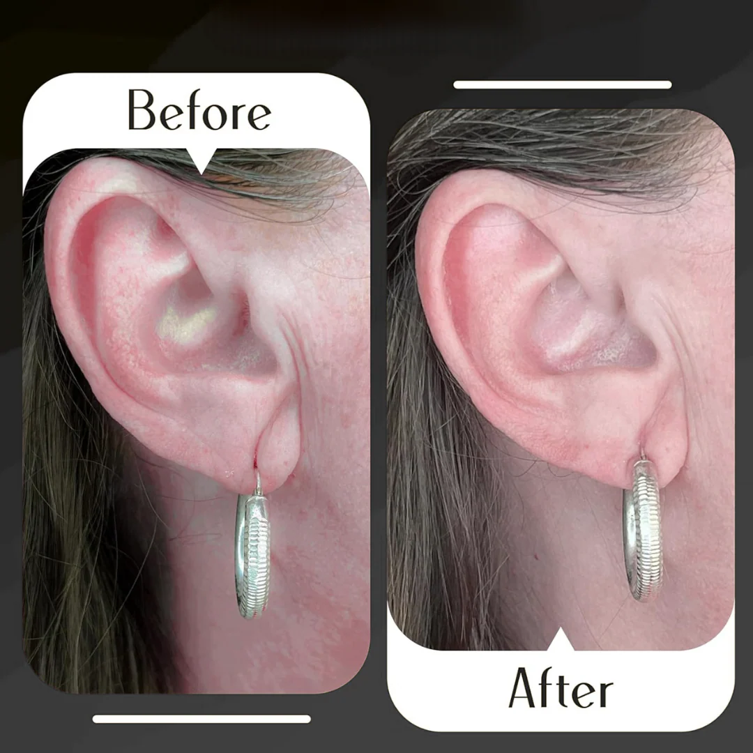 Earlobe Support Patches (100 PCS)