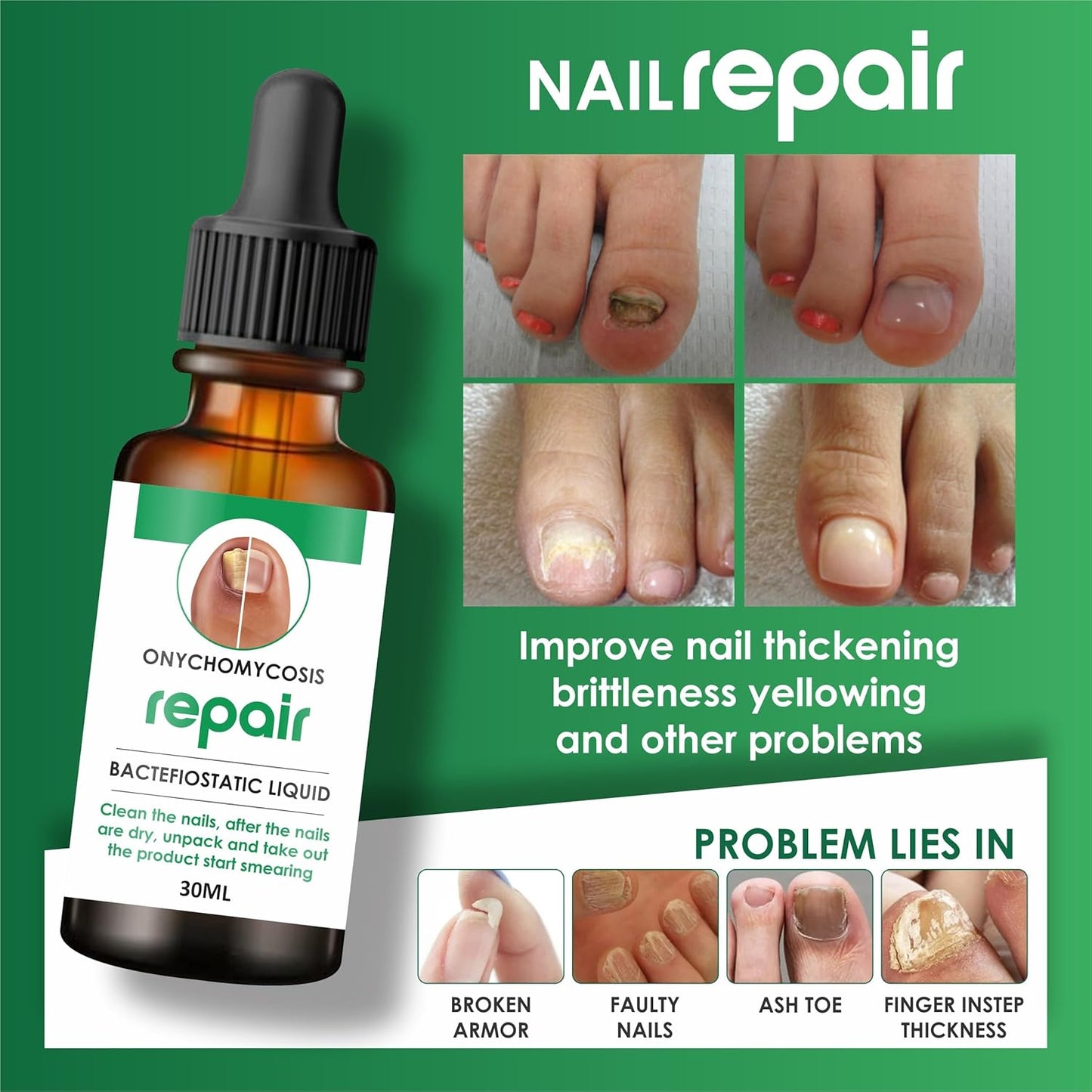 Professional Nail Repair Serum - 100% Natural, Anti-Infective, Fungal Infection Removal, 30ML