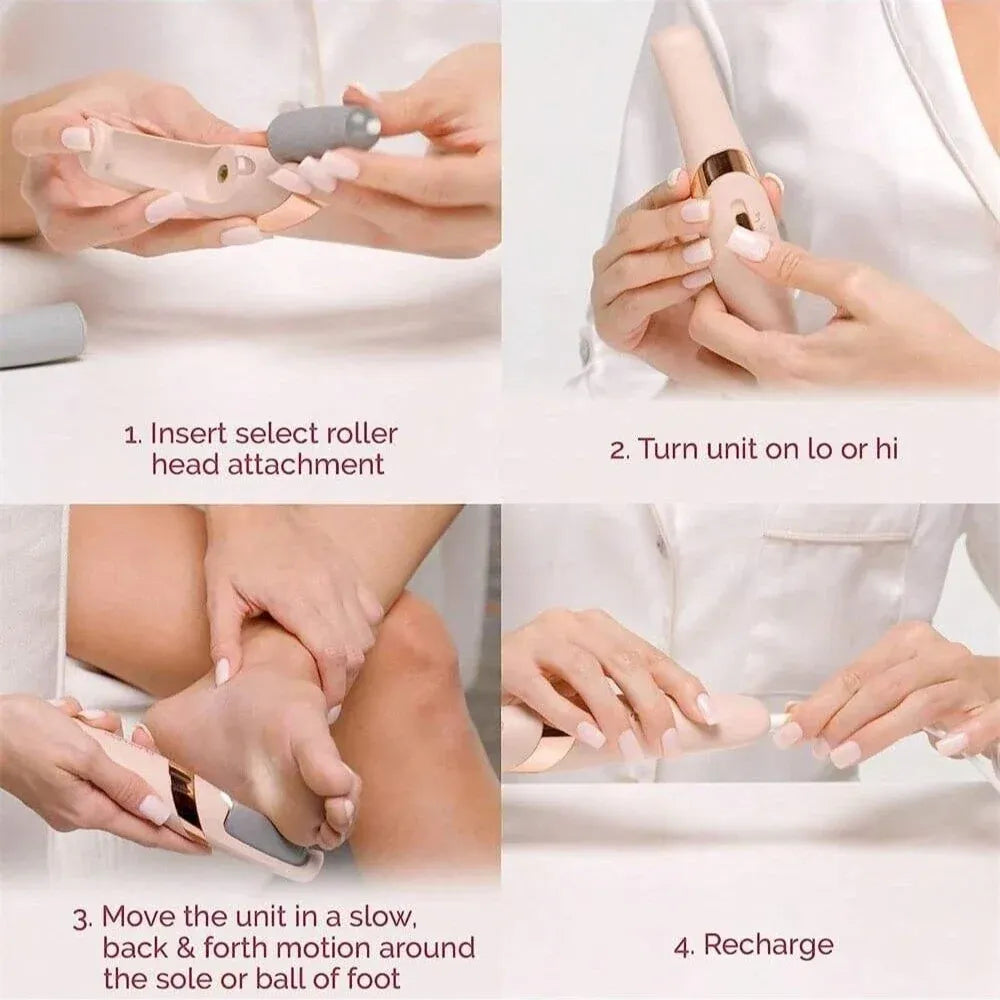 Rechargeable Callus Remover for Feet | Foot Scrubber for Dead Skin