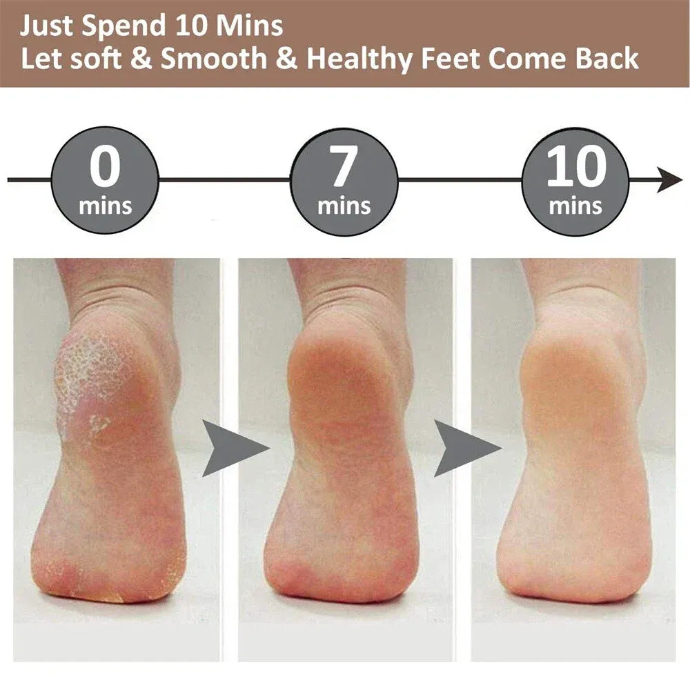 Rechargeable Callus Remover for Feet | Foot Scrubber for Dead Skin